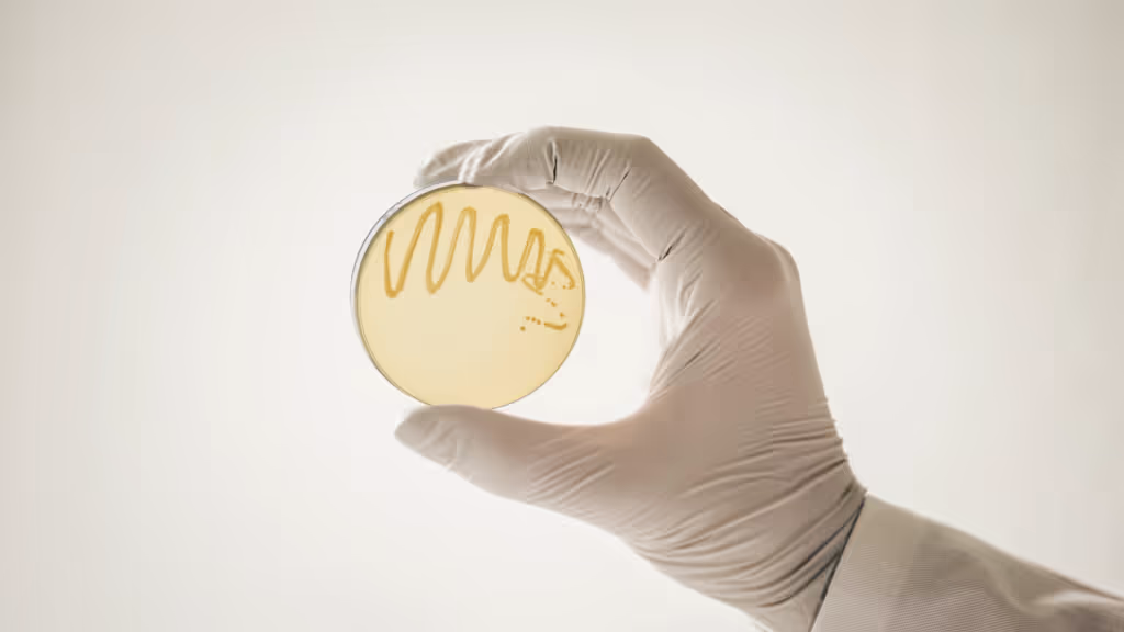 Agar plate with colonies of E.coli